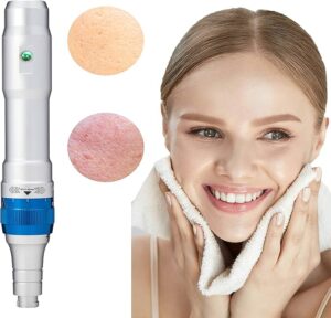 Dr. Pen Ultima A6 Microneedling Pen | Skin Rejuvenation & Collagen Booster - Image 4