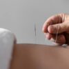 Energy Sterile Acupuncture Needles (100-Pack) with Guide Tube