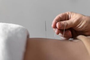 Energy Sterile Acupuncture Needles (100-Pack) with Guide Tube